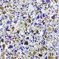 Terrazzo Glass Tile - TG2225